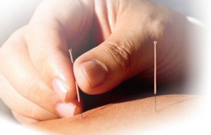 ACUPUNCTURE: Le bien-être et la santé au naturel