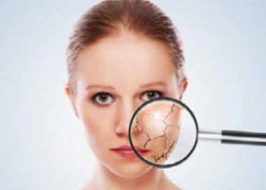 Conseils pour lutter contre les écailles de la peau...