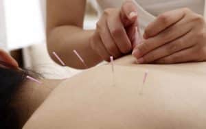 Explorez les bienfaits de l'acupuncture dans la gestion du diabète pour une approche holistique de la santé.